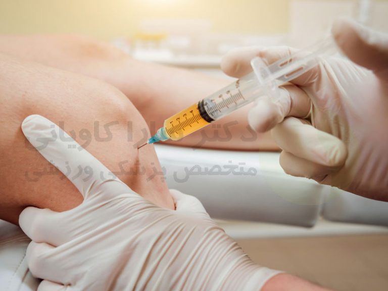 آسپیراسیون مفصلی یا آنالیز مایع مفصلی چیست؟ دکتر سارا کاویانی متخصص